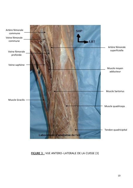 Répartition de nos patients selon le sexe - Faculté de Médecine et ...