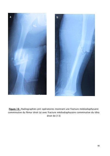 Répartition de nos patients selon le sexe - Faculté de Médecine et ...