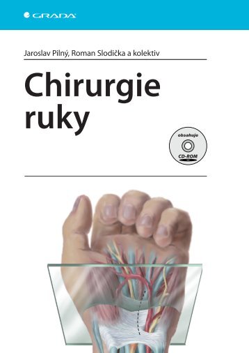 Chirurgie ruky - eReading