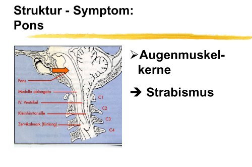 Klinische Symptome der Arnold-Chiari II ... - Die Asbh-Stiftung ist