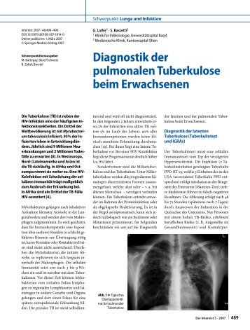 Diagnostik der pulmonalen Tuberkulose beim ... - Erkan Arslan