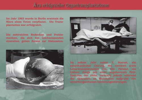 Organtransplantation