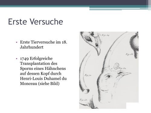 Die Geschichte der Transplantation