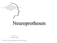 Neuroprothesen