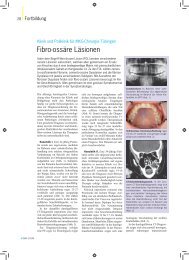 Fibro-ossäre Läsionen - Erste-zahnarztmeinung.de