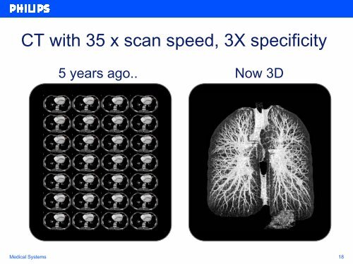 Philips Medical Systems Progress Report