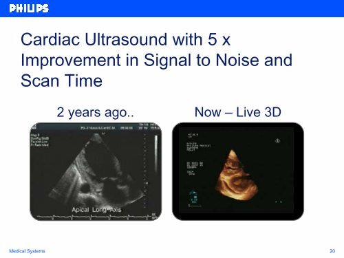 Philips Medical Systems Progress Report