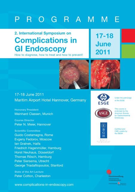 2 International Symposium On Complications In Gi Endoscopy Esge