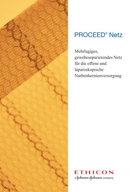 PROCEED® Netz - Ethicon Products