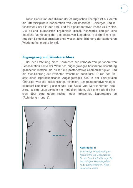 Fast-Track in der Abdominalchirurgie Fast-Track in der ... - Ethicon