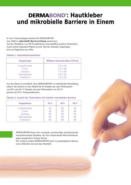 Dermabond OP-Einsatz - Ethicon