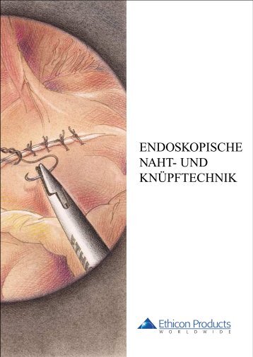 ENDOSKOPISCHE NAHT- UND KNÜPFTECHNIK - Ethicon