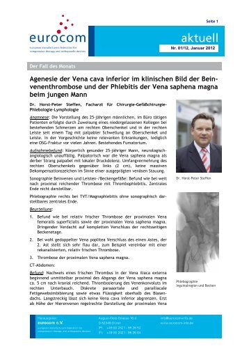 Agenesie der Vena cava inferior im klinischen Bild der Bein - eurocom