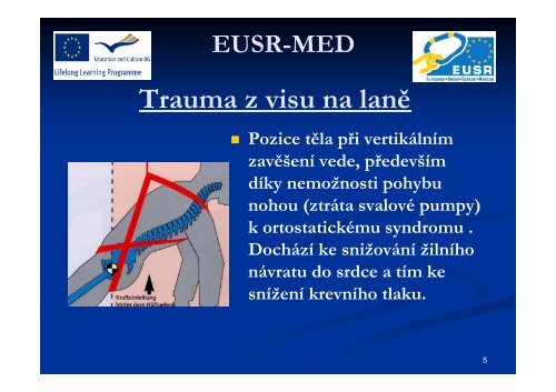 Trauma z visu na laně - EUSR