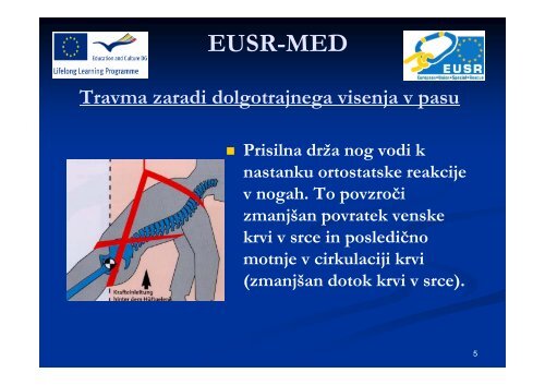 Travma zaradi dolgotrajnega visenja v pasu EUSR-MED