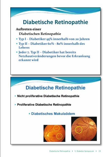 V. Diabetes-Symposium - Asklepios