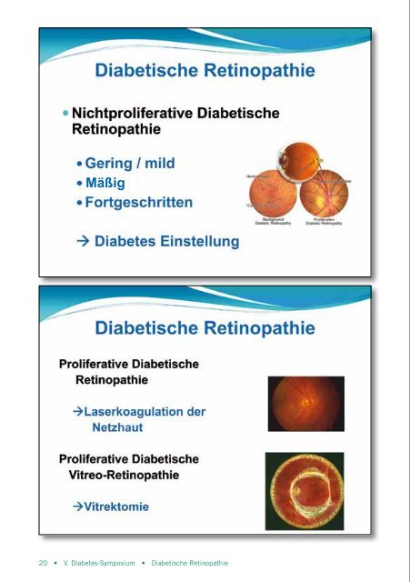 V. Diabetes-Symposium - Asklepios