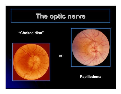 CLINICAL OPHTHALMOLOGY