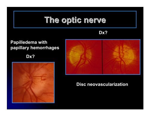 CLINICAL OPHTHALMOLOGY