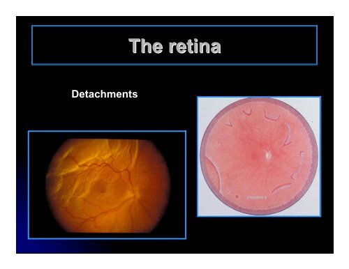 CLINICAL OPHTHALMOLOGY