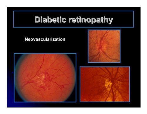 CLINICAL OPHTHALMOLOGY