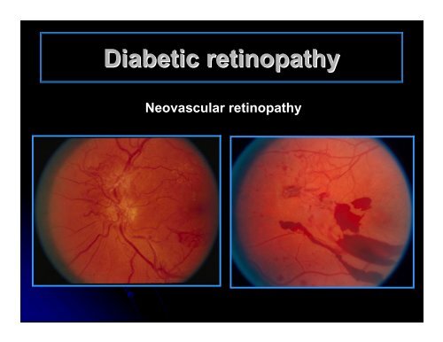 CLINICAL OPHTHALMOLOGY