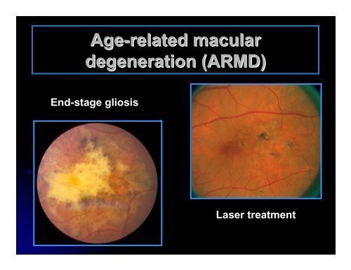 CLINICAL OPHTHALMOLOGY