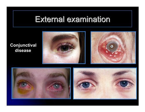 CLINICAL OPHTHALMOLOGY