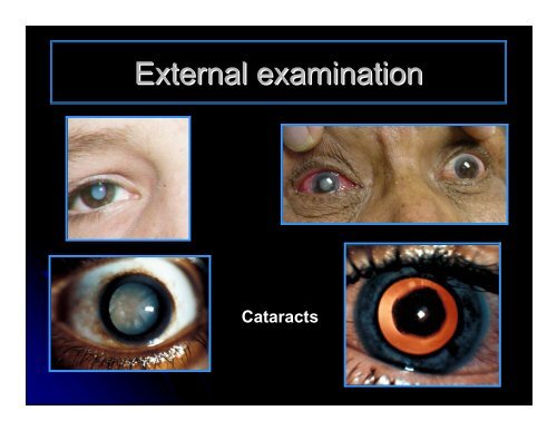 CLINICAL OPHTHALMOLOGY