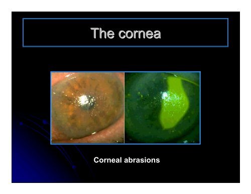 CLINICAL OPHTHALMOLOGY