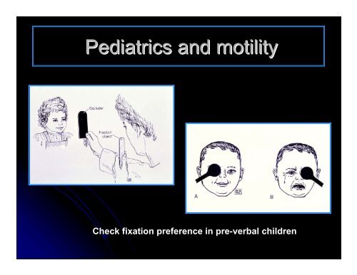 CLINICAL OPHTHALMOLOGY