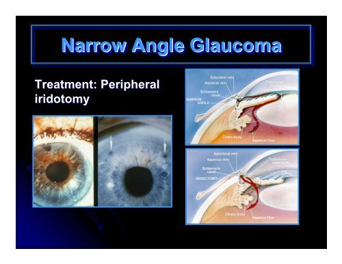 CLINICAL OPHTHALMOLOGY