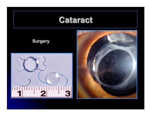 CLINICAL OPHTHALMOLOGY