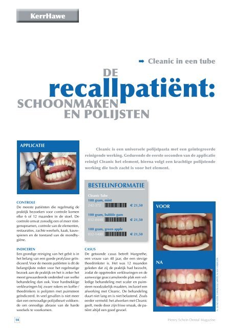 KiJK SneL oP - Henry Schein