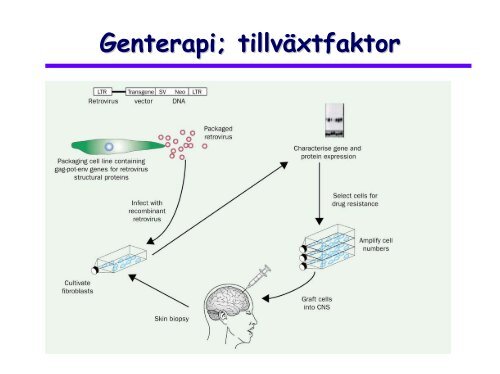 Mild kognitiv svikt - IVA