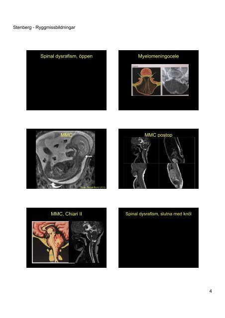 Kongenitala missbildningar, radiologiska fynd