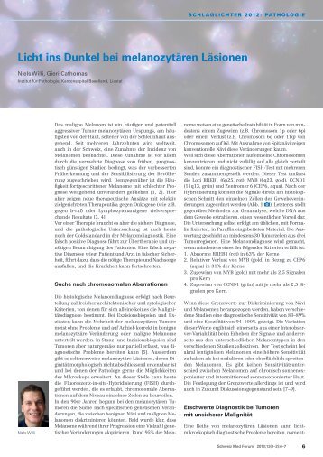 Licht ins Dunkel bei melanozytären Läsionen - Swiss Medical Forum