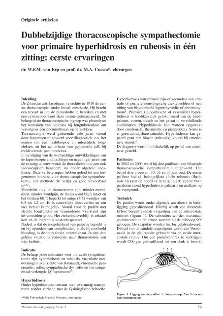 Dubbelzijdige thoracoscopische sympathectomie voor primaire ...