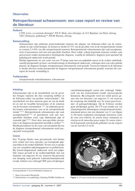 Retroperitoneaal schwannoom: een case report en review van de ...