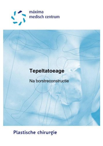 Tepeltatoeage na borstreconstructie - Máxima Medisch Centrum