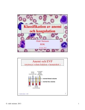 Klassifikation av anemi och koagulation - RDK