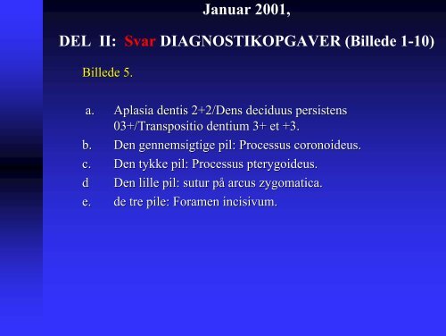 Januar 2001, DEL I: FLERVALGSOPGAVER (1-10) Opgave 1 ...