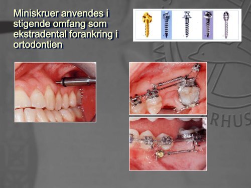 Nødbehandling af ortodontiske patienter