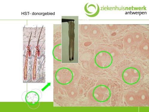 Opvang en behandeilng van brandwonden - Belsurg