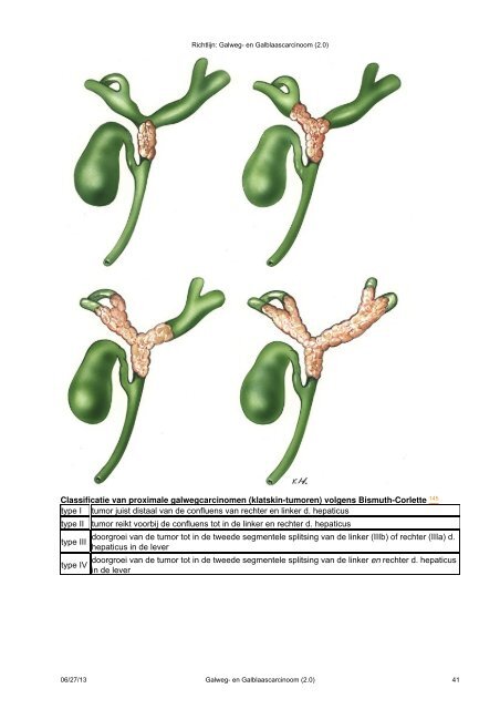 Galweg- en Galblaascarcinoom - Genootschap van Maag-Darm ...
