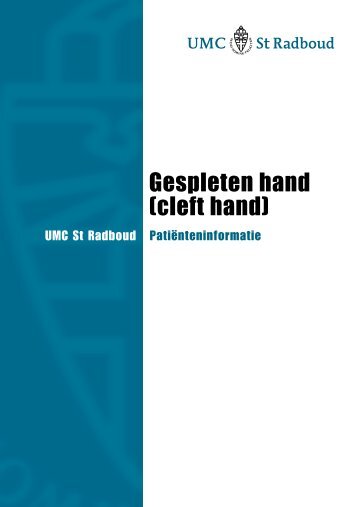 Gespleten hand (cleft hand) - UMC St Radboud