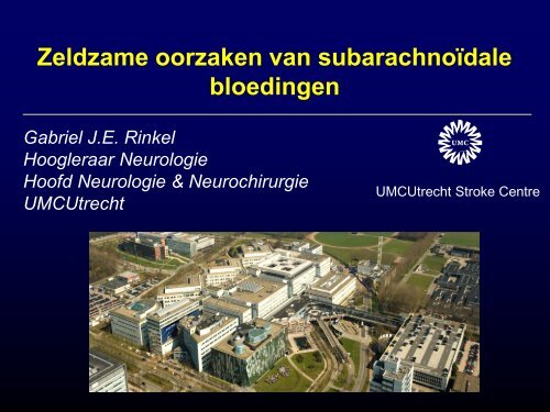 Zeldzame oorzaken van een subarachnoïdale bloeding - UMC Utrecht