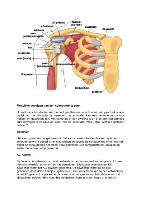 Acute schouderblessure - Chirurg en operatie