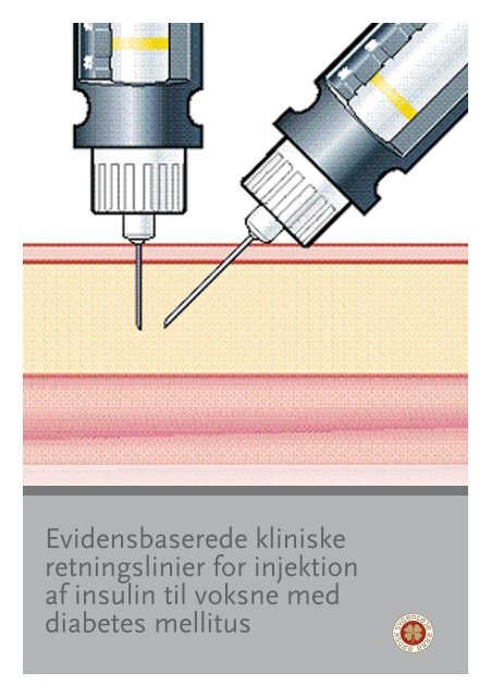 Evidensbaserede kliniske retningslinier for injektion af insulin til ...