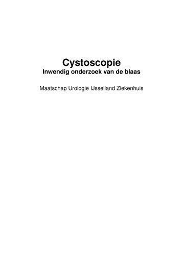 Cystoscopie - IJsselland Ziekenhuis